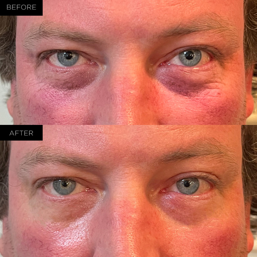 Endure™ Beauty Organic Awakening Under Eye Therapy Gel Pads