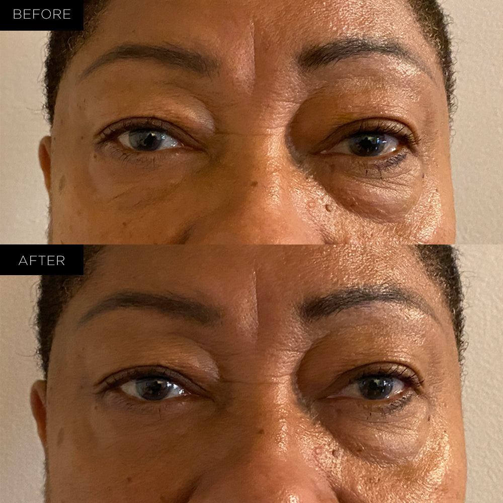 Endure™ Beauty Organic Awakening Under Eye Therapy Gel Pads