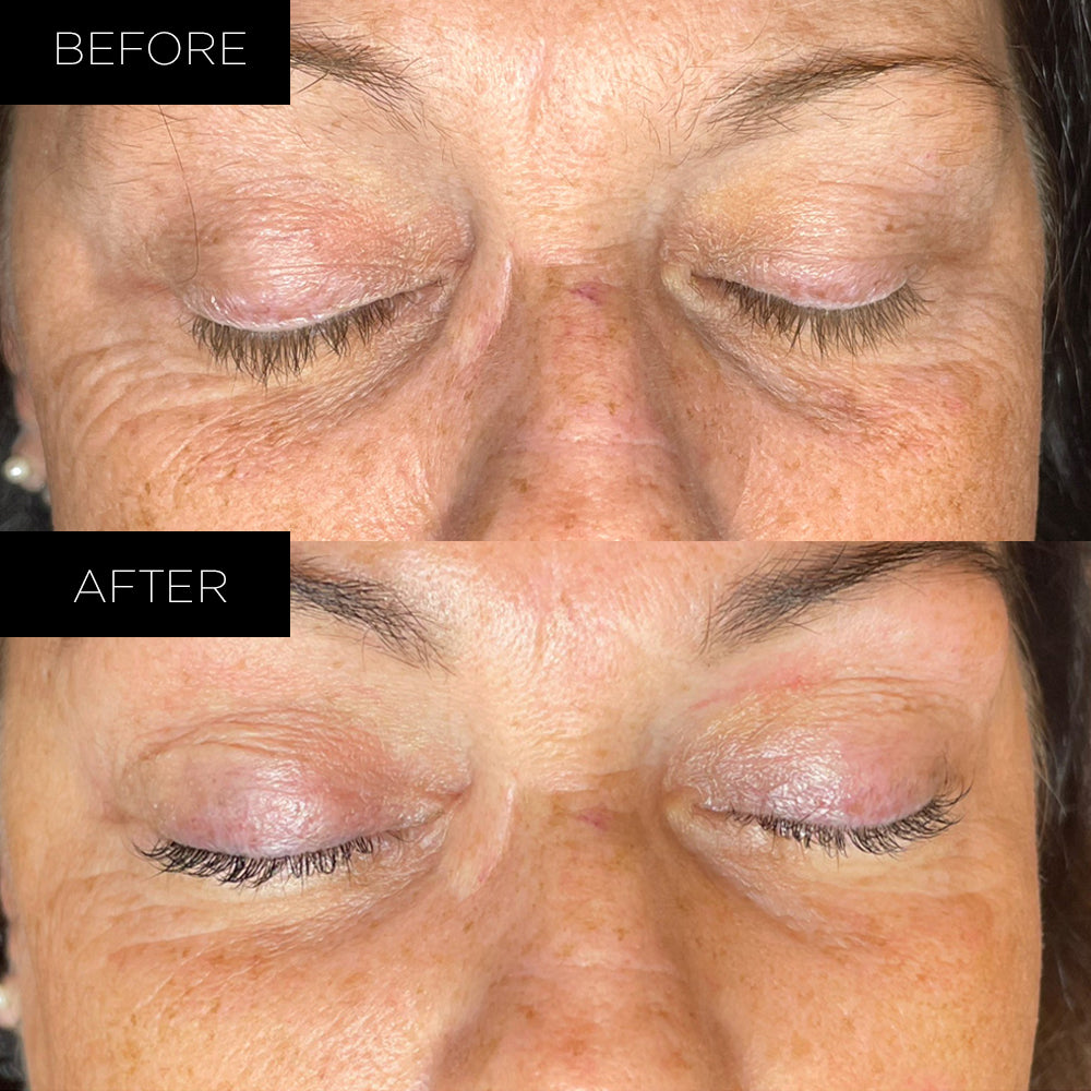 Endure™ Beauty Organic Awakening Under Eye Therapy Gel Pads