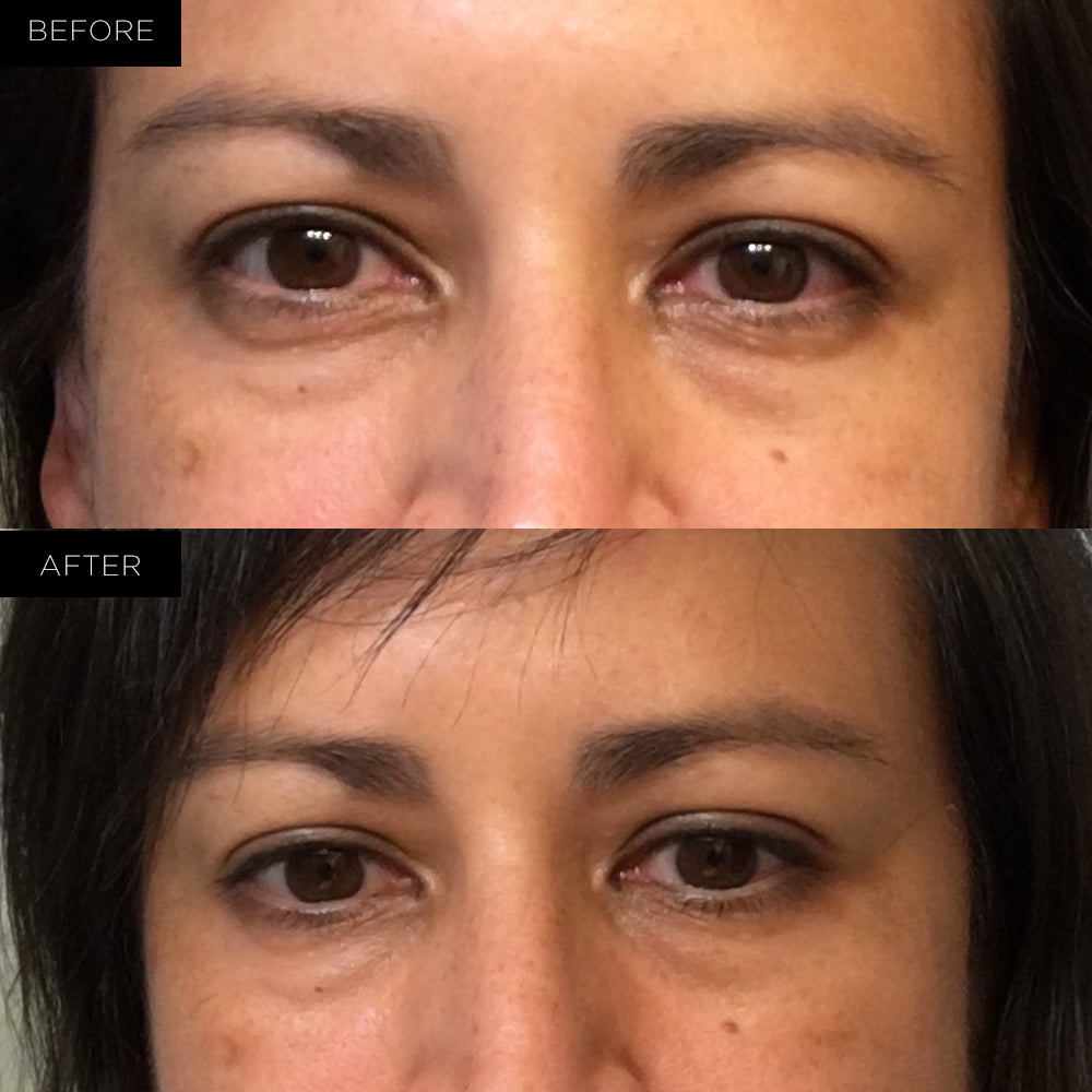 Endure™ Beauty Organic Awakening Under Eye Therapy Gel Pads