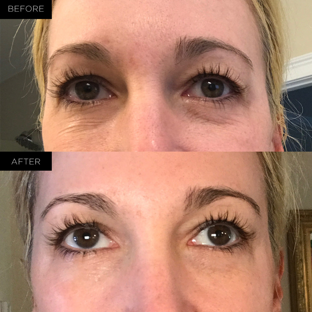 Endure™ Beauty Organic Awakening Under Eye Therapy Gel Pads