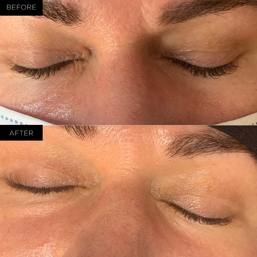 Endure™ Beauty Organic Awakening Under Eye Therapy Gel Pads