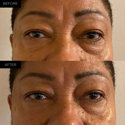 Endure™ Beauty Organic Awakening Under Eye Therapy Gel Pads