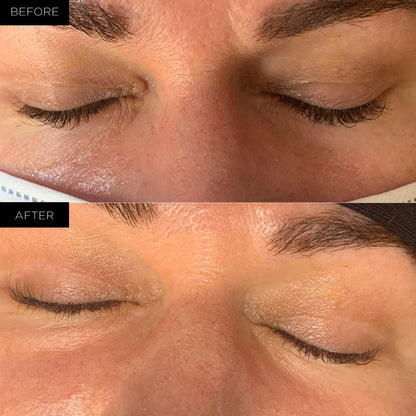 Endure™ Beauty Organic Awakening Under Eye Therapy Gel Pads
