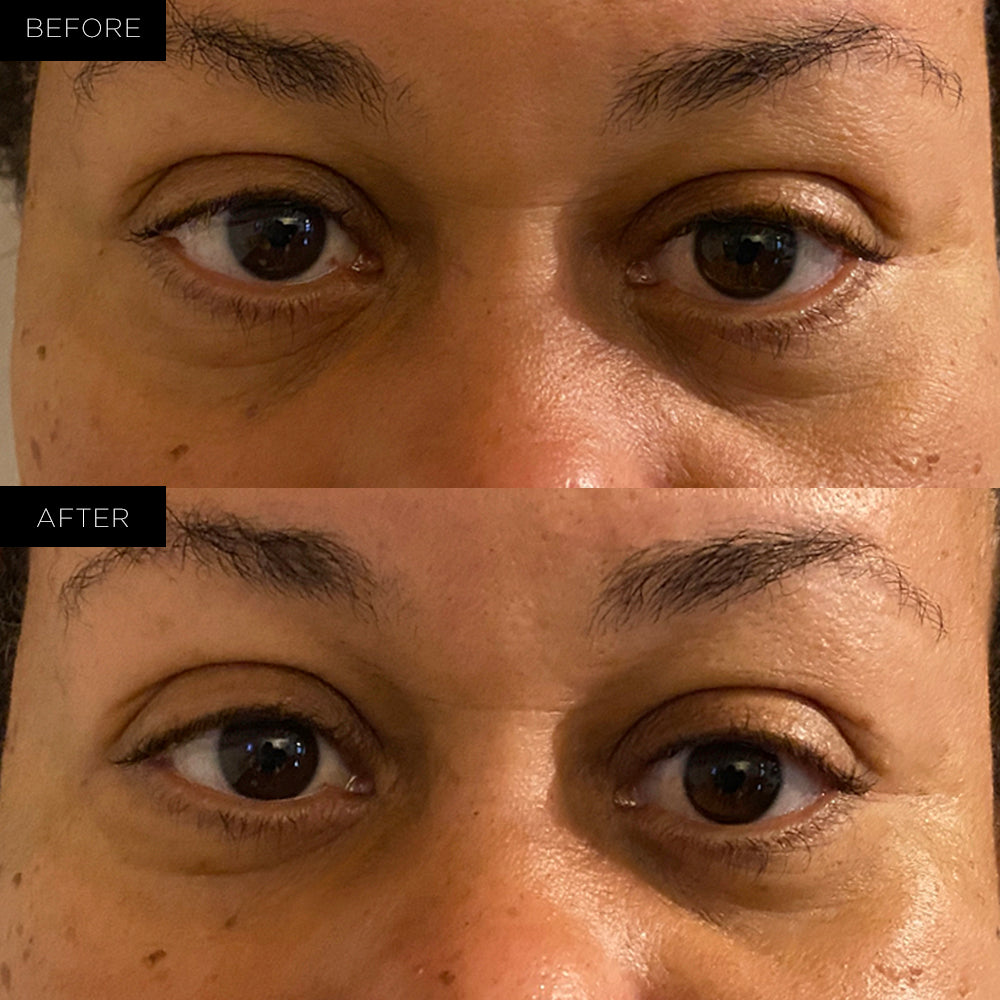Endure™ Beauty Organic Renewing Under Eye Therapy Gel Pads